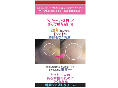 美白クリーム（アルバニアＳＰホワイトニングクリーム）の広告表示